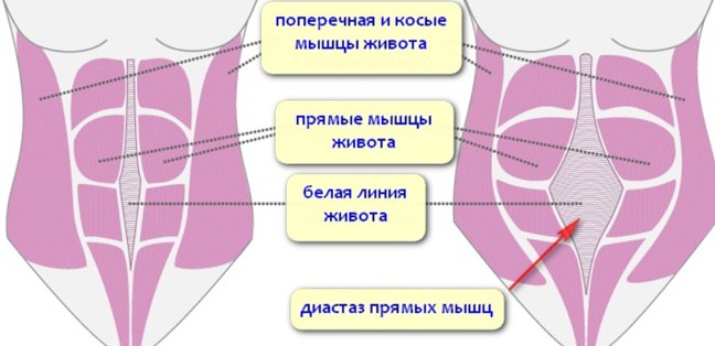 Що робити з обвислій шкірою на животі і боках після пологів